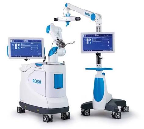 ROSA Joints